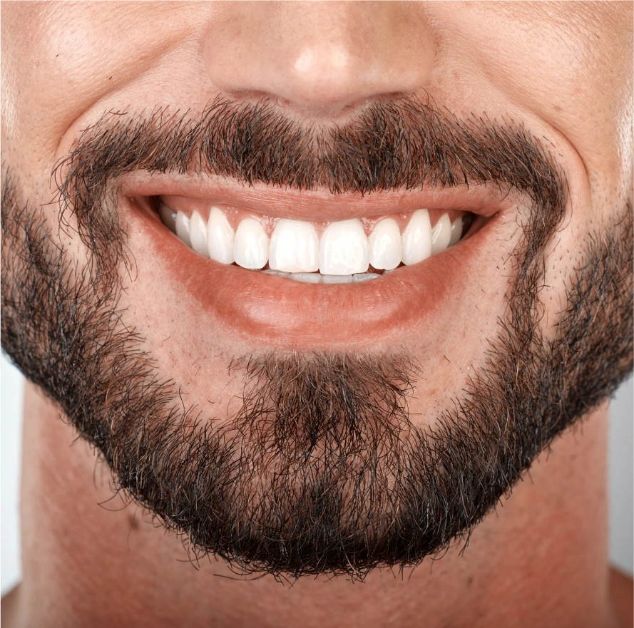 Candidates for Chin Filler Treatment for Men in Boston, MA Banner
