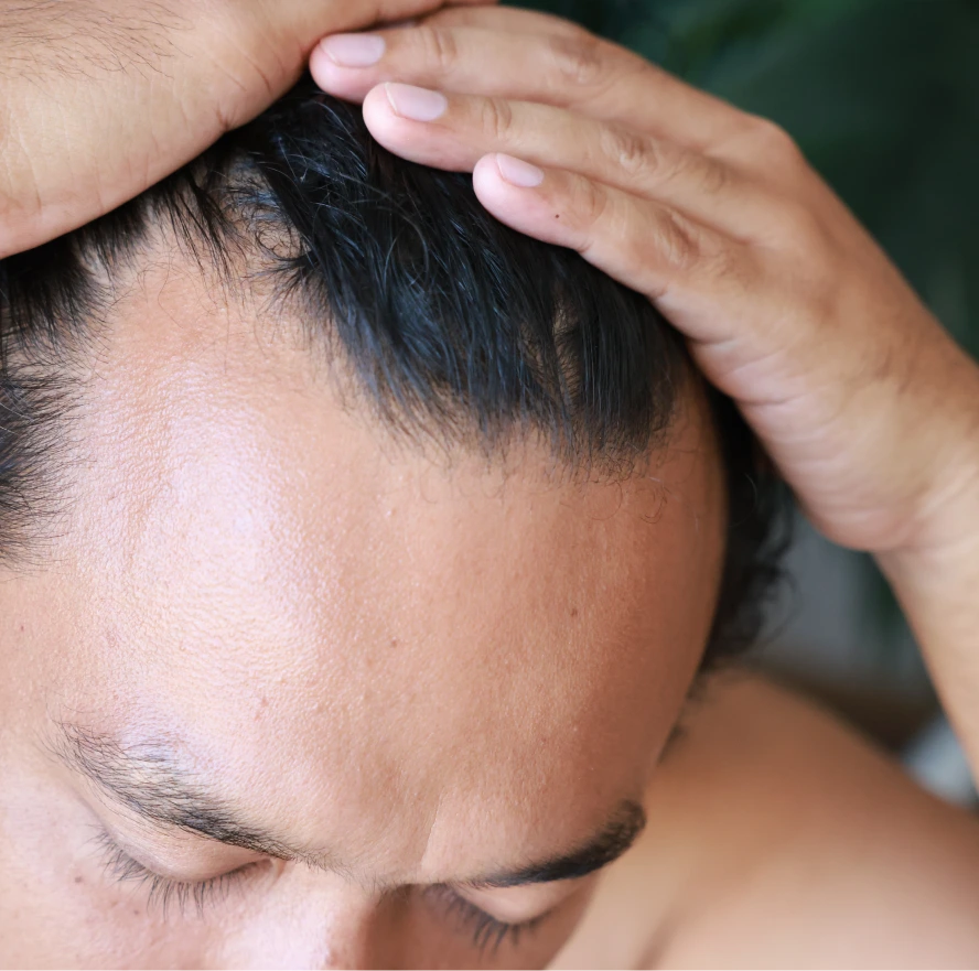 Candidates for FUT Hair Restoration Boston, Massachusetts Banner