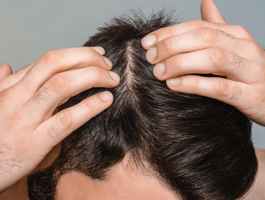 Hair Restoration Treatment in Boston, MA Banner