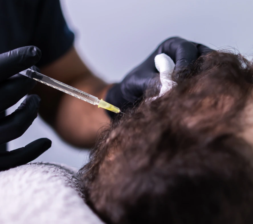 Non-Surgical Hair Restoration in Boston, MA Banner